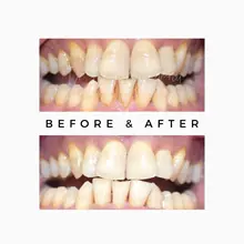 Case Study Image